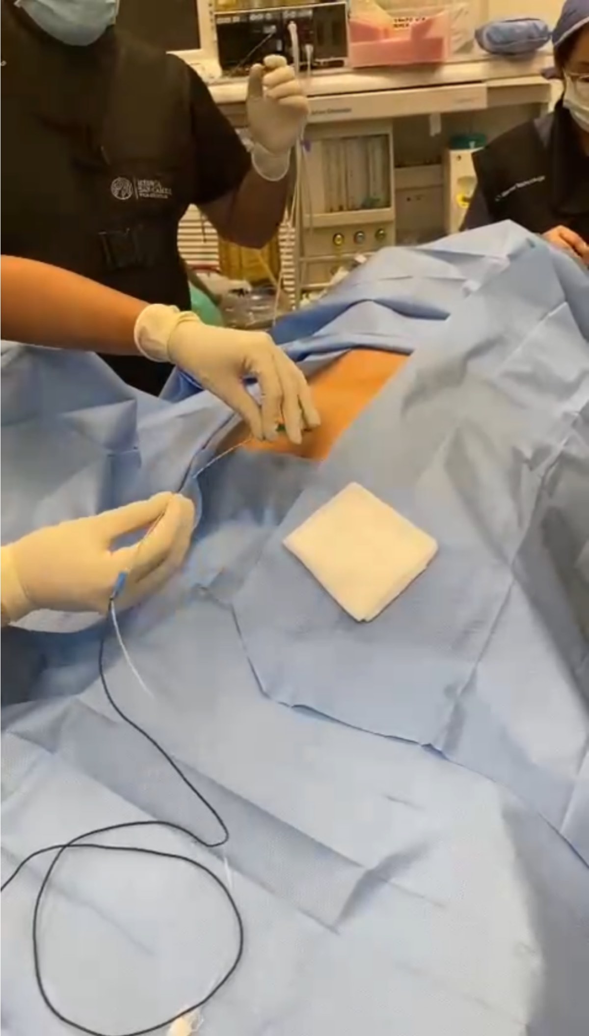 Радиочастотный катетер AXON и MedGs совершает революцию в минимально инвазивной хирургии 1